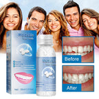 Cosmetic dental veneer showing its natural-looking smile design
