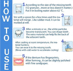 Tooth repair kit arranged for at-home use
