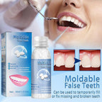 Removable cosmetic dental veneer displayed against a clean background