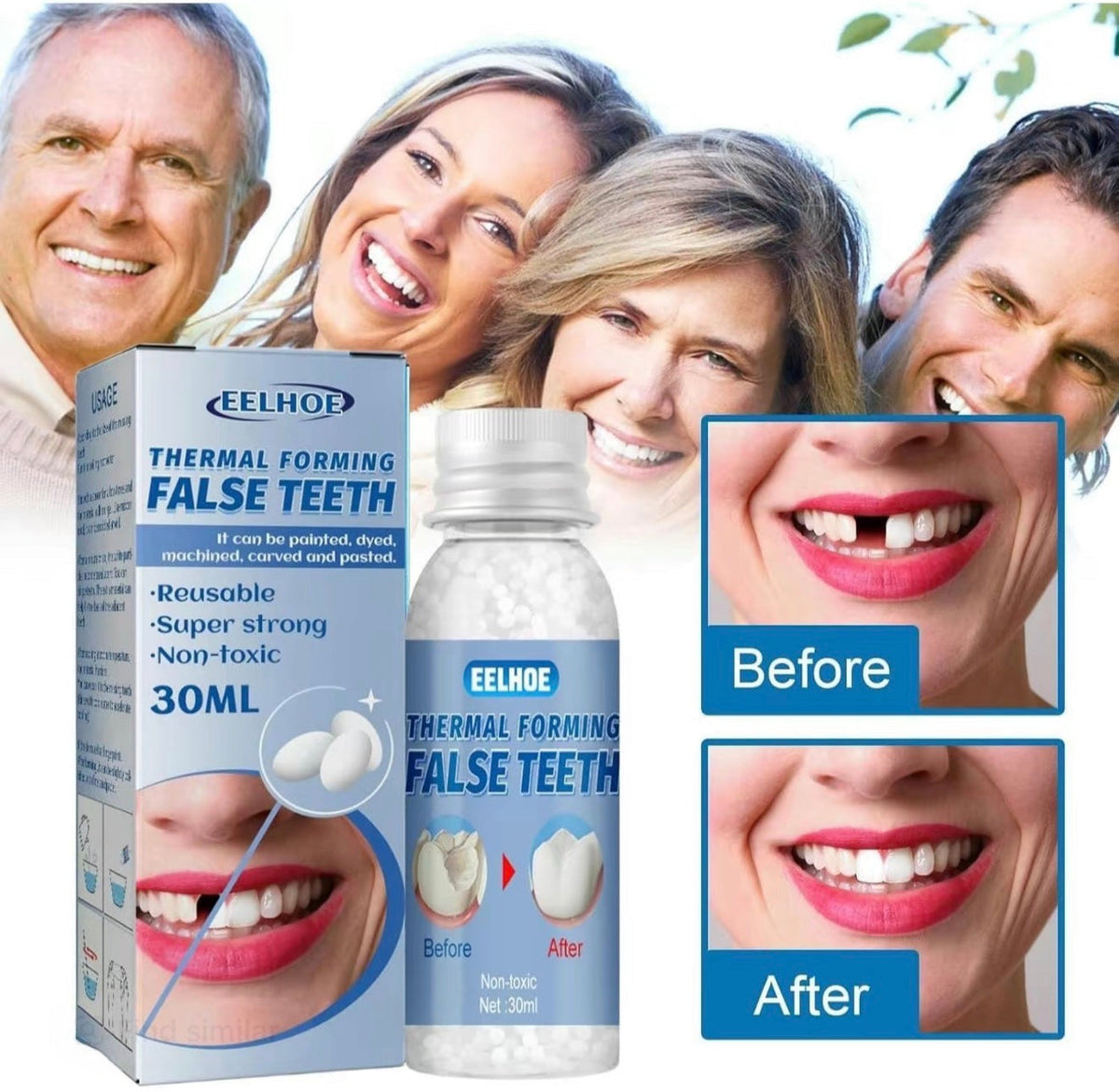 Temporary dental repair resin close-up