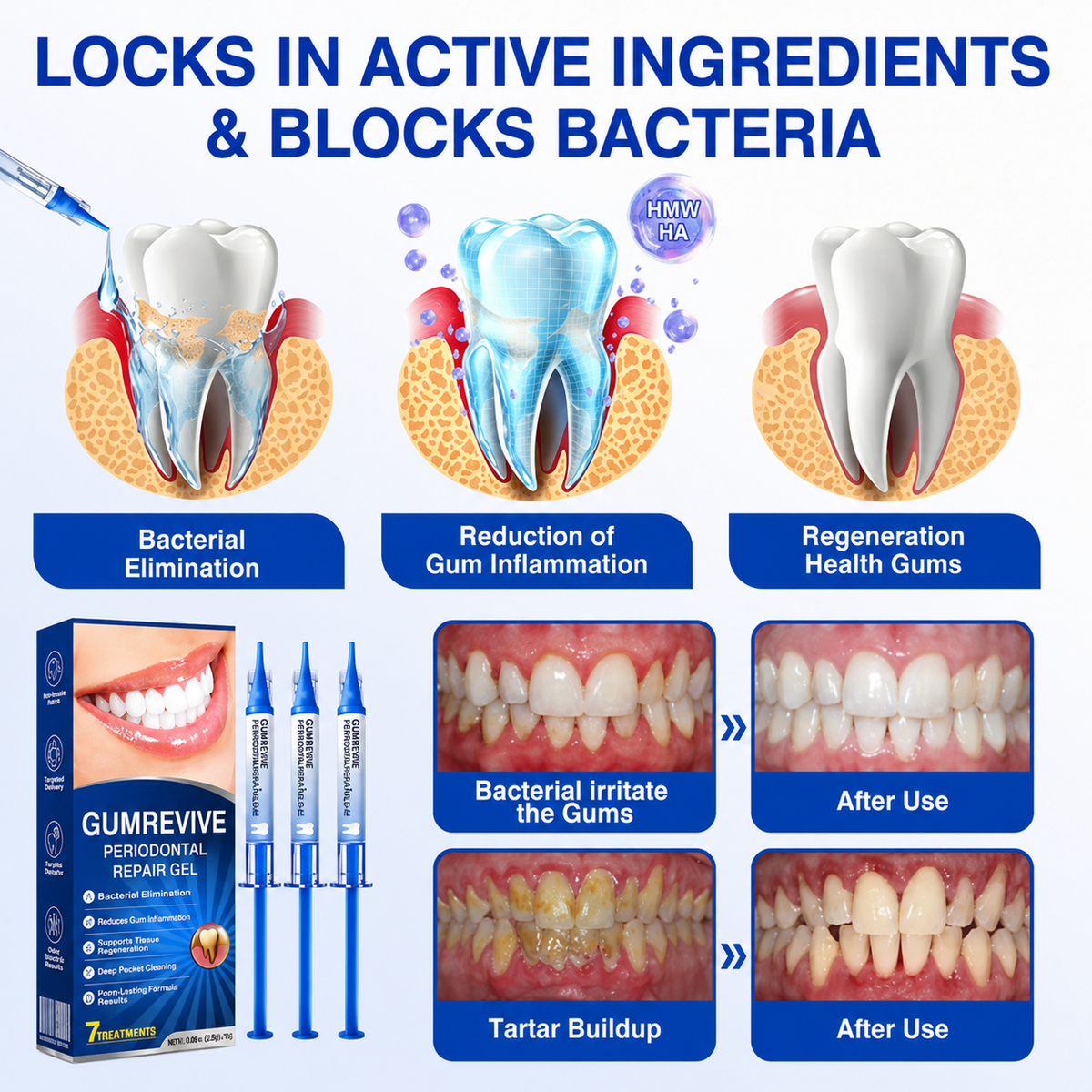 Oral hygiene gel for daily dental routines
