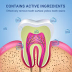 Micotix Whitening Strips