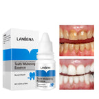 Teeth whitening liquid bottle for oral care and plaque cleansing