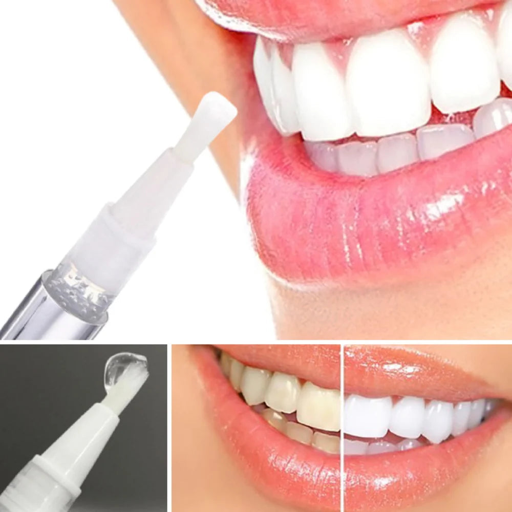 Close-up of teeth whitening pen applicator