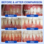 Daily Gum And Enamel Care Gel for everyday oral care