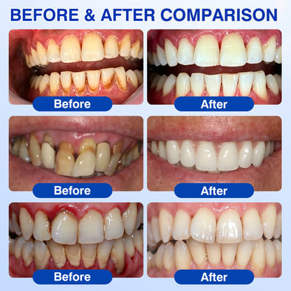 Gum and enamel care gel product shown clearly