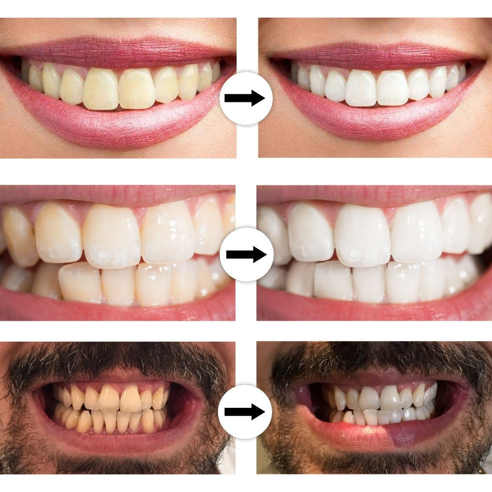 Gentle toothbrush for comfortable everyday oral care