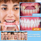 Close-up of the flexible dental mouthpiece designed for a personalised fit