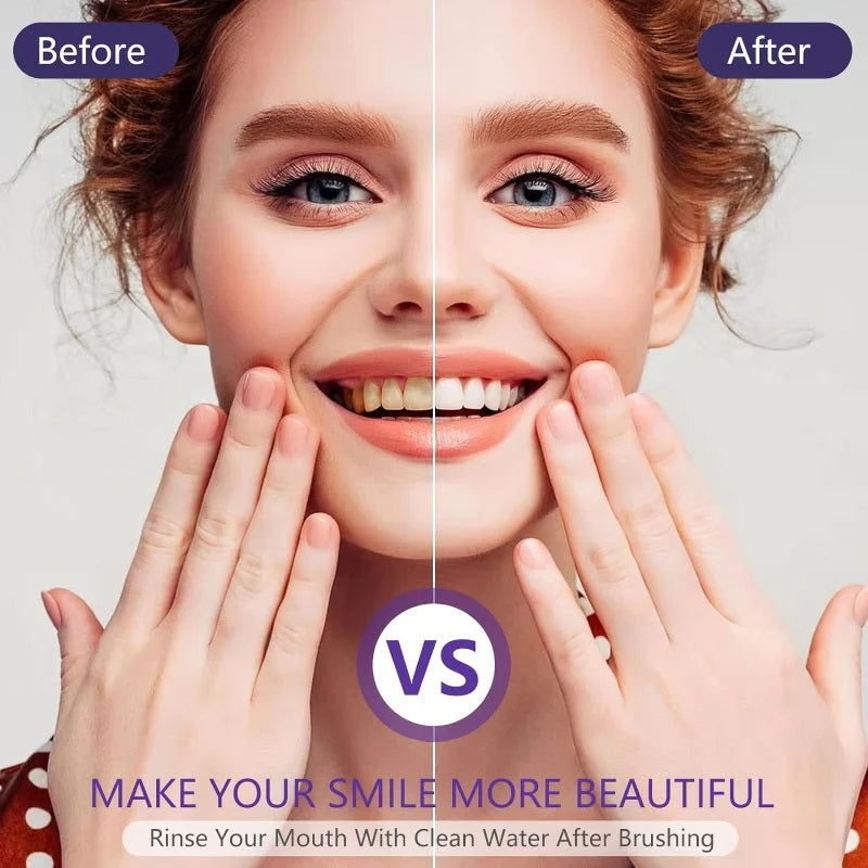 Micotix Teeth Whitening Gel